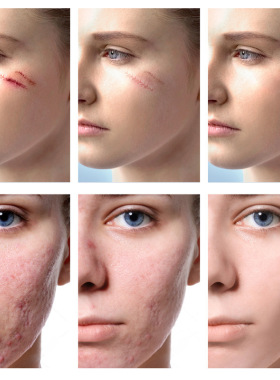 Repair gel Remove scar Repair skin Brighten skin colour 消痕