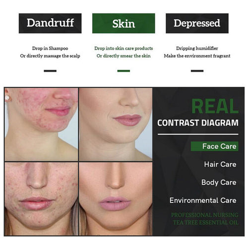 tea tree tea tree oil pure essential oil Face acne cream - 图0