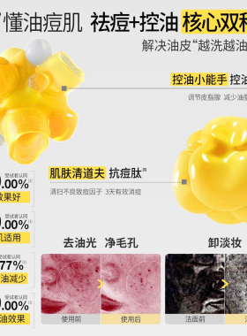 羽素双肽祛痘控油洗面奶深层清洁
