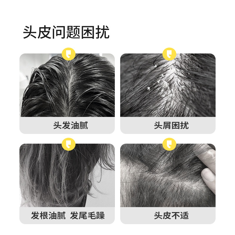 羽素净屑蓬松洗发露护发轻盈控油洁清爽柔顺深层养护男女 羽素净屑蓬松洗发露护发轻盈控油洁清爽柔顺深层养护男女