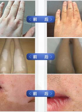 黑色素防水持久脸部遮瑕霜