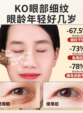 黄铜小莲蓬眼部按摩器面部脸部金丝檀木拨筋棒点穴美容疏通经络刷