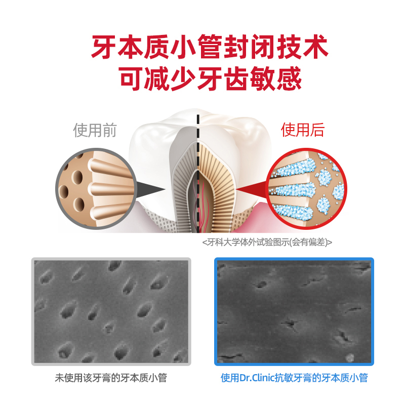 韩国进口爱敬2080牙膏抗过敏牙膏牙齿敏感牙龈护理清新口气