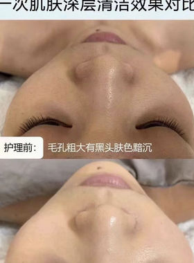 丸碧实体店同款氨基酸植萃清颜净澈套盒清洁肌肤祛黑头净肤洁颜