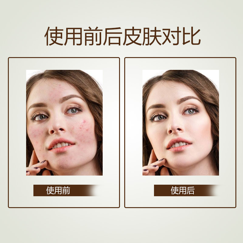 美国RB Radha Beauty20% VC玻尿酸精华60Ml淡化痘印 滋润 - 图0