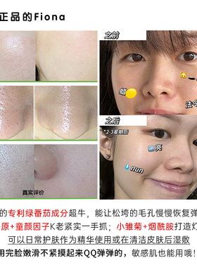 毛孔救星 韩国SUNGBOON绿番茄毛孔精华改善粗大毛孔补水保湿
