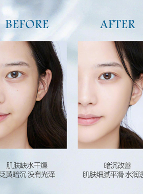 Lancome兰蔻极光精华水混油皮