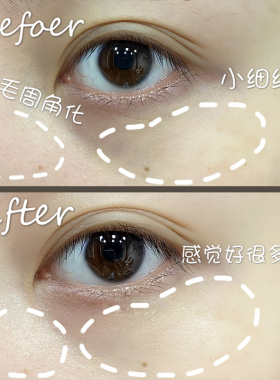 新版兰蔻小黑瓶发光超修眼霜