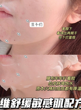 好用！优色林舒安修护面膜补水保湿舒缓敏感肌泛红积雪草痘肌