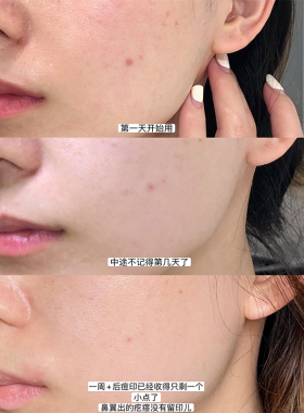 褒曼医生臻白精华乳3号 Medature烟酰胺提亮肤色改善暗沉15ml