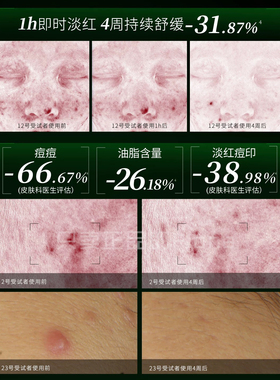 初尹新品！油橄榄传明酸清修精华40ml控油抗氧褪红防反黑橄榄精华
