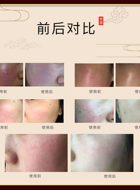 角质修复霜皮肤角质薄敏感肌