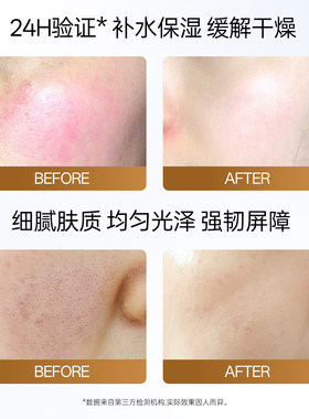 Dopi积雪草修护精华面霜晒后夏季补水保湿滋润泛红敏感肌舒缓面霜