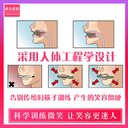 微笑矫正器器练习器嘴角上扬训练器笑容瘦脸面罩唇形嘴唇锻练提拉 - 图1