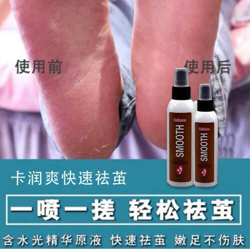 德国callusan卡润爽卡茧去茧足部护理祛茧软化死皮足部去角质 - 图0