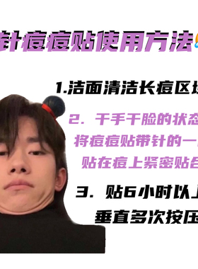 韩国oliveyoung微针祛痘贴