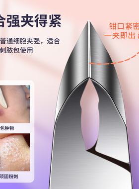 把黑头统统揪出来手持式黑头钳