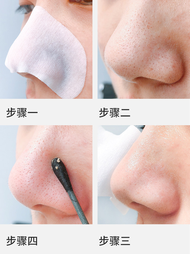 韩国cnp去黑头紧致收缩毛孔鼻贴膜 海囤美妆鼻帖