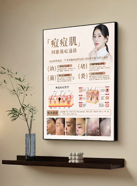美容院装饰画斑痘敏对比图墙壁画