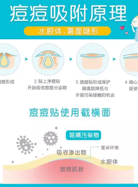 护妍天使痘痘贴隐形遮瑕