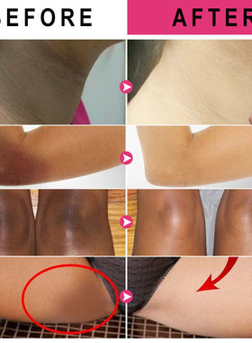 VitaminC Whitening Cream For Dark Skin Lighten Pigment Crotc