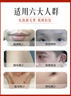 浓密眉毛发际线增长液
