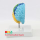 Anatomical neurocortical model of the right hemiplegia of the human brain