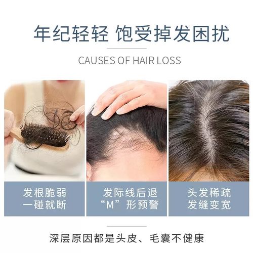 美国NIOXIN丽康丝1号2号300ml进口洗发水护发素套装防掉发防脱 - 图0