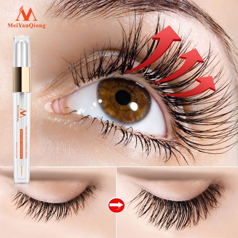 Eyelash Growth Enhancer Natural Medicine Treatments Lash Eye - 图2