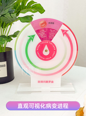 宫颈进程逆转演示罗盘亚克力材质妇科健康自我检测科普美容院