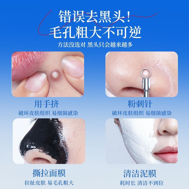 Konka/康佳吸黑头神器美容仪家用脸部小气泡黑头毛孔清洁吸出器 - 图1