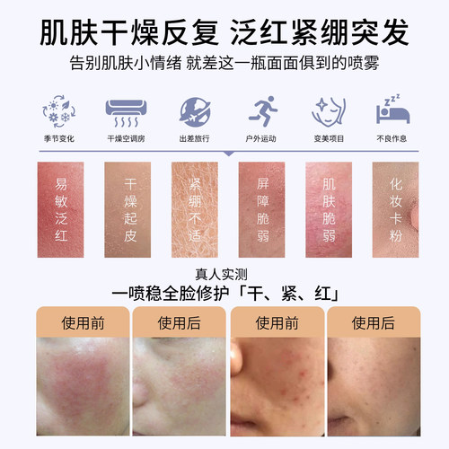 【爆品升级】MEDSPA法国美帕维生素B5喷雾小分子补水保湿厚脸皮水 - 图3