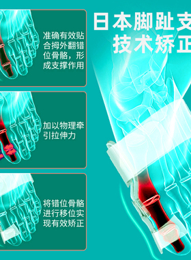 大拇指脚骨母外反士日夜矫形器