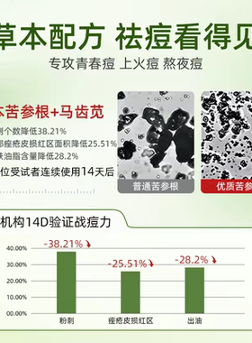 【假一罚十】水初语草本祛痘膏