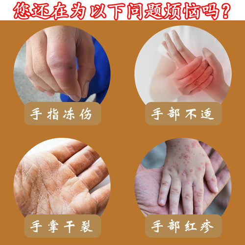 玖敷佳原始点电加热红豆袋手套热敷手部指关节冻疮肩颈温敷理疗袋 - 图0
