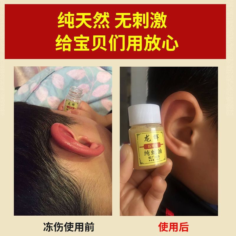 纯蛇油50毫升买一送一冻伤烫伤美容护肤五步蛇油,淘宝优惠券,粉丝福利购,淘宝优惠卷