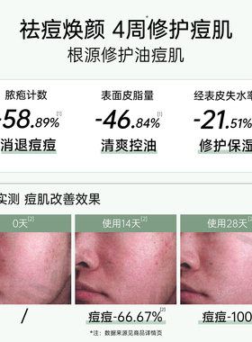 植物医生祛痘正品！控油水乳套装