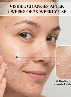 美国直邮Vivo Per Lei Facial Peeling Gel 温和面部去角质凝胶