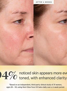 美国直邮KORA Organics Noni Glow Face Oil轻薄好吸收面部精华液