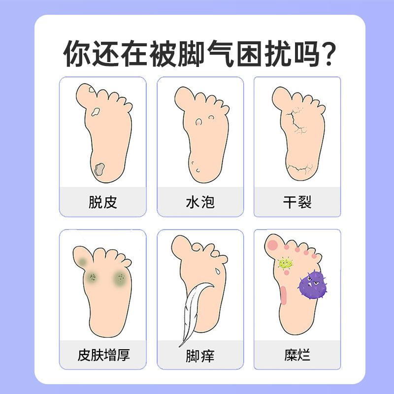  德开大药房旗舰癣症