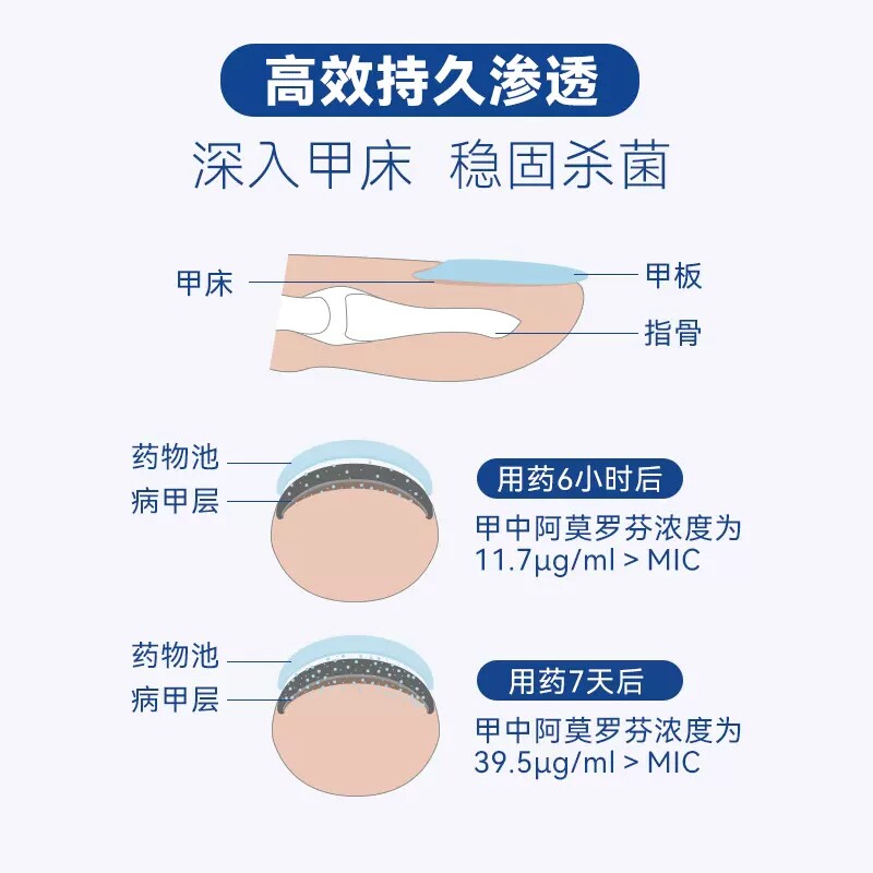  泉源堂大药房癣症