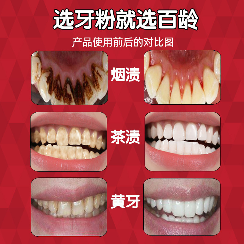 台湾百龄洁克130g洗牙粉 牙博士家居牙刷/口腔清洁工具