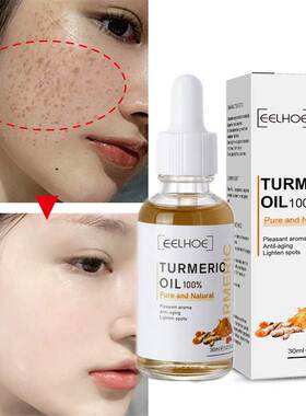 Turmeric Freckle Whitening Serum Curcumin Oil Brighten Fade