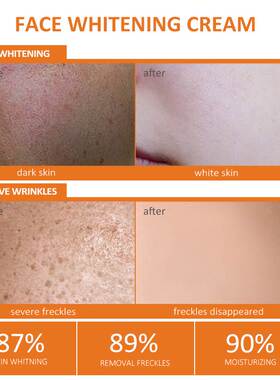 Vitamin C Skin Care Sets Face Whitening Cream Facial Moistur