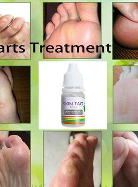10ml Skin Tag Remover Wart Treatment Papillomas Removal Liqu