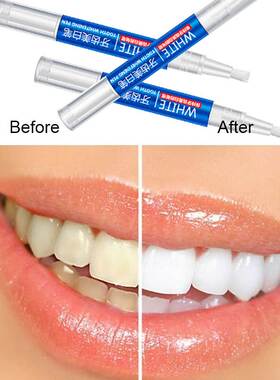 2.5ML Bright White Teeth Whitening Gel Pen Bleaching tooth S