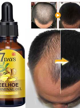 Hair Growth Products Ginger Fast Growing Hair Essential Oil