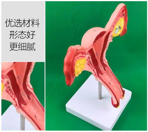 人体子宫模型教具模具阴道卵巢解剖病理医学女性仿真女性生殖模器 - 图0