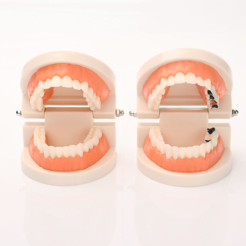 牙齿模型幼儿园早教刷牙模具标准两倍假牙科儿童宝宝口腔教学道具 - 图0