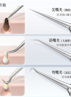 粉刺夹超细细胞夹镊子挑挤痘痘